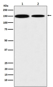 KDM4A Rabbit Monoclonal Antibody