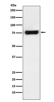 MTA2 Rabbit Monoclonal Antibody