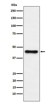 ABHD5 Rabbit Monoclonal Antibody