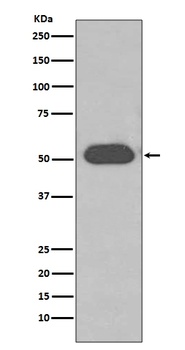 GC/VDBP Rabbit Monoclonal Antibody