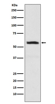 alpha Internexin INA Rabbit Monoclonal Antibody