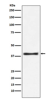Aspartate Aminotransferase Rabbit Monoclonal Antibody