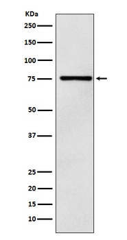 DCP1A Rabbit Monoclonal Antibody