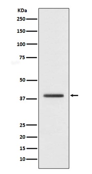 macroH2A.1 H2AFY Rabbit Monoclonal Antibody