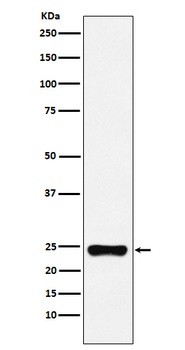 BAG2 Rabbit Monoclonal Antibody