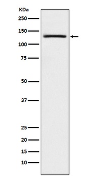 USP28 Rabbit Monoclonal Antibody