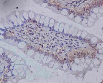 Musashi 1 MSI1 Rabbit Monoclonal Antibody