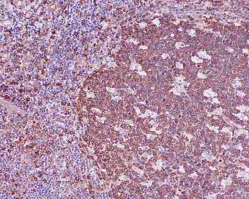 beta I Tubulin TUBB1 Rabbit Monoclonal Antibody