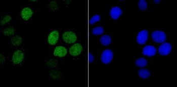 Histone H1.2/H1 Rabbit Monoclonal Antibody