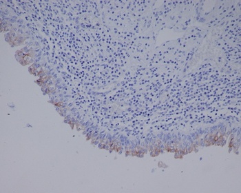 Uroplakin3a UPK3A Rabbit Monoclonal Antibody