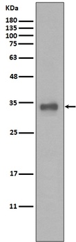 Calponin CNN1 Rabbit Monoclonal Antibody