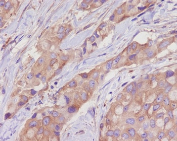 alpha Tubulin TUBA1B Rabbit Monoclonal Antibody