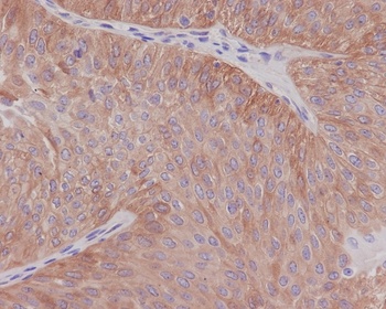 alpha Tubulin TUBA1B Rabbit Monoclonal Antibody