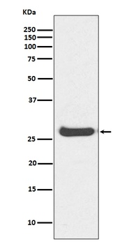 Histone H1.0 H1F0/H1 Rabbit Monoclonal Antibody
