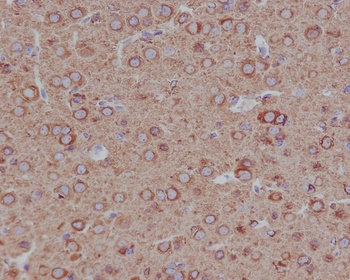 Tubulin beta 4B/2A/2B Rabbit Monoclonal Antibody