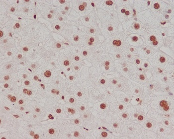 Methyl-Histone H3 HIST1H3A Rabbit Monoclonal Antibody