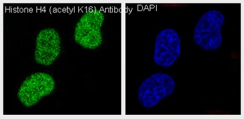 Histone H4 HIST1H4A Rabbit Monoclonal Antibody