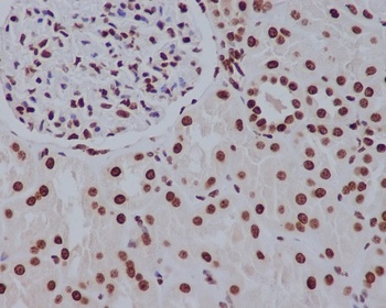 Histone H2A.Z H2afz/H2A Rabbit Monoclonal Antibody