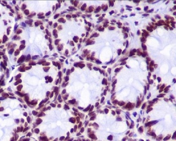 Histone H2A HIST1H2AB Rabbit Monoclonal Antibody