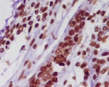 Histone H2A HIST1H2AB Rabbit Monoclonal Antibody