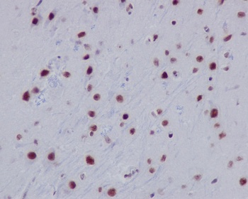 Histone H2A HIST1H2AB Rabbit Monoclonal Antibody