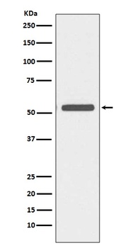 Cytokeratin 6 Rabbit Monoclonal Antibody