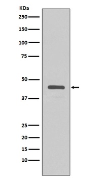V5-Tag/V5 Rabbit Monoclonal Antibody