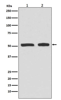 Phospho-p53 TP53 Rabbit Monoclonal Antibody