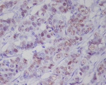 Phospho-p53 TP53 Rabbit Monoclonal Antibody