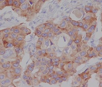 Phospho-mTOR Rabbit Monoclonal Antibody