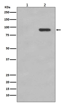 Phospho-beta Catenin CTNNB1 Rabbit Monoclonal Antibody