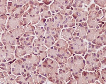 Phospho-STAT3/STAT3 Rabbit Monoclonal Antibody