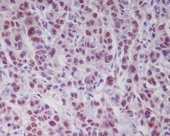 Phospho-ATM/ATM Rabbit Monoclonal Antibody