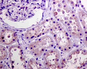 Phospho-Akt AKT1 Rabbit Monoclonal Antibody