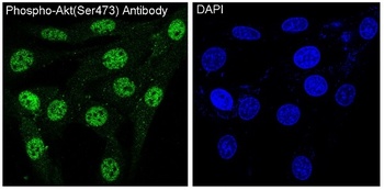 Phospho-Akt AKT1 Rabbit Monoclonal Antibody