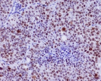 Phospho-c-Myc Rabbit Monoclonal Antibody