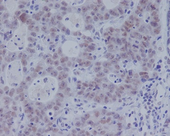 Phospho-Smad3 Rabbit Monoclonal Antibody