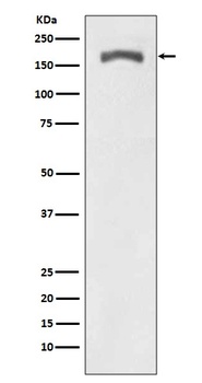 Phospho-PDGF Receptor beta PDGFRB/PDGF Rabbit Monoclonal Antibody