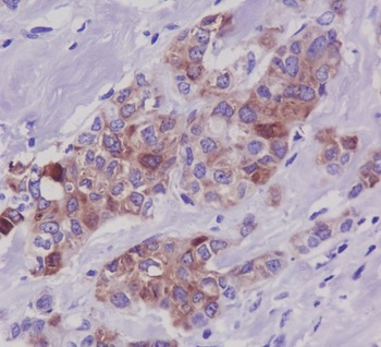 Phospho-Tau MAPT Rabbit Monoclonal Antibody