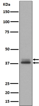 Phospho-Erk1 + Erk2 MAPK3 Rabbit Monoclonal Antibody