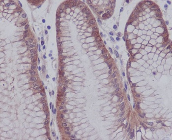 Phospho-YAP1/YAP1 Rabbit Monoclonal Antibody