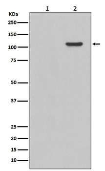 Phospho-FAK PTK2/FAK Rabbit Monoclonal Antibody