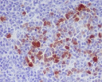 Phospho-Cdk1/2 Rabbit Monoclonal Antibody