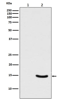 Phospho-alpha Synuclein SNCA Rabbit Monoclonal Antibody