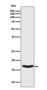 Phospho-alpha Synuclein SNCA Rabbit Monoclonal Antibody