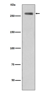 Phospho-LRRK2/LRRK2 Rabbit Monoclonal Antibody