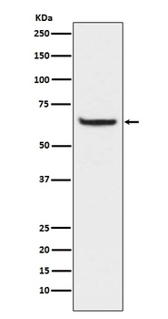 Phospho-NF-Kappa B p65 RELA/NF Rabbit Monoclonal Antibody