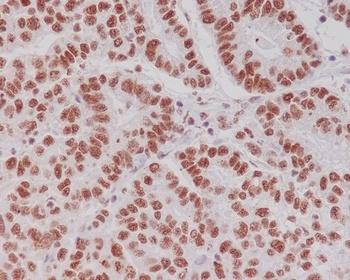 Phospho-Creb CREB1 Rabbit Monoclonal Antibody