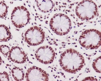Phospho-DNA PKcs PRKDC/DNA Rabbit Monoclonal Antibody