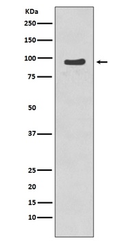 Phospho-p95/NBS1 NBN Rabbit Monoclonal Antibody